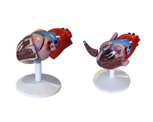 心臟解剖(自然大)(附病態(tài)動(dòng)脈血管)