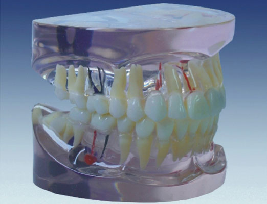 透明乳牙發(fā)育模型