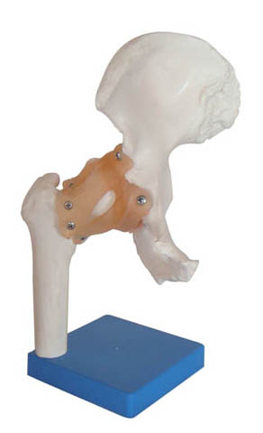髖關(guān)節(jié)模型